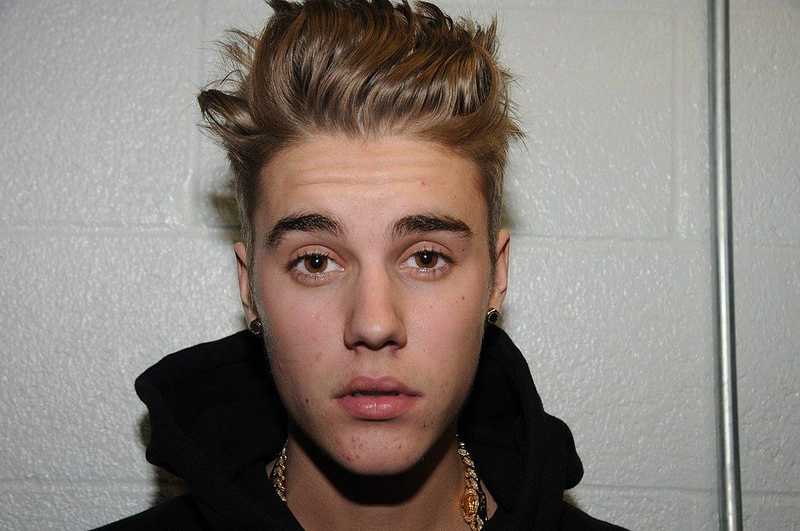 Justin Bieber elárulta, hogy Lyme-kórban szenved