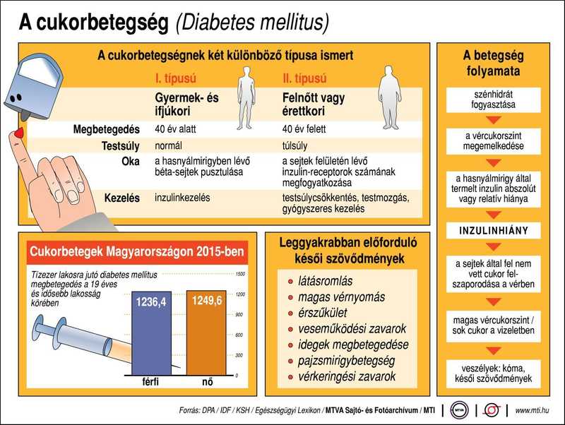 A szemlencse vizsgálatával előre jelezhető a 2-es típusú diabétesz